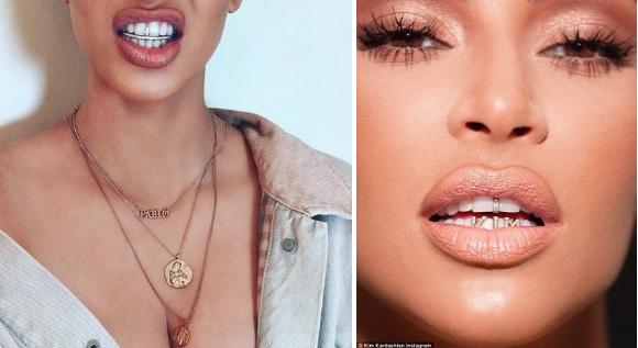 Kim Kardashian khoe răng đính kim cương-2