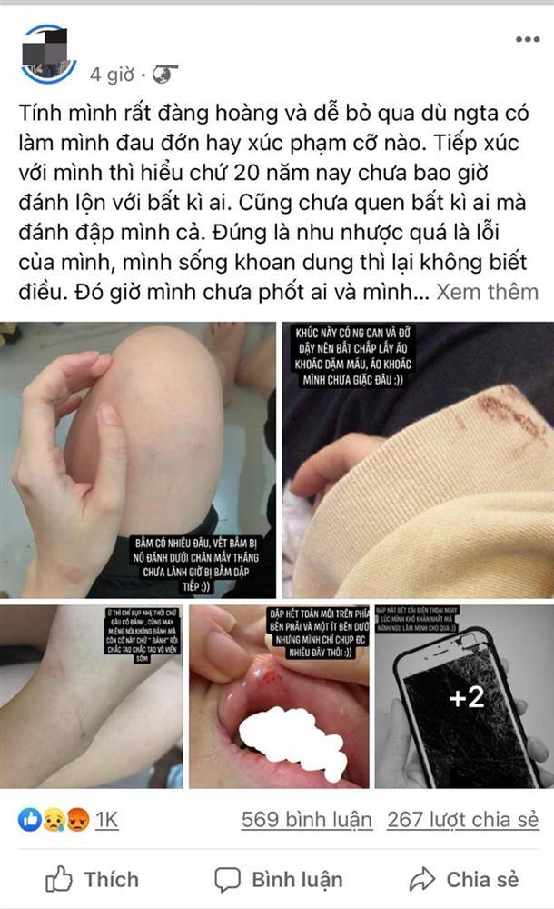 Điểm danh loạt bạn trai khiến hội chị em nguyện... không thoát ế!-7