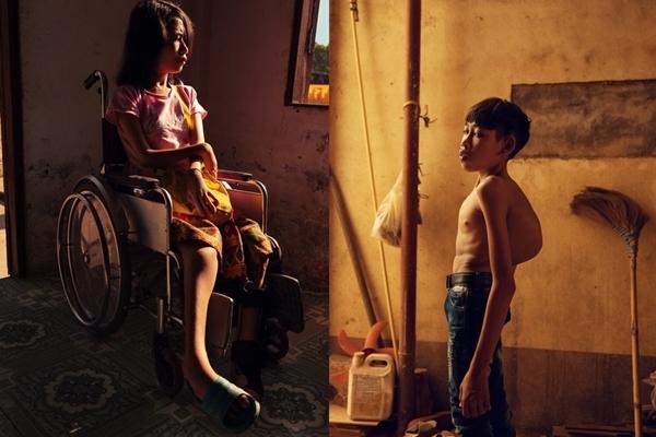 Tòa án Pháp bác đơn kiện về chất độc da cam của bà Trần Tố Nga-2