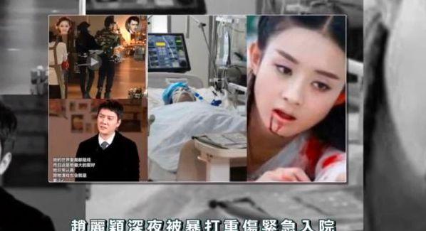 Động thái của Triệu Lệ Dĩnh sau tin đồn bị chồng đánh nhập viện-1