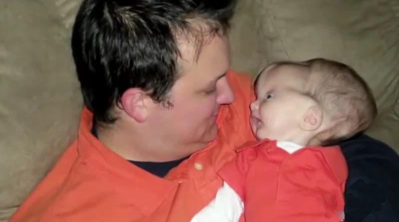 Bé trai sinh ra não úng thủy, dung mạo hiện tại khiến ai cũng trầm trồ-4