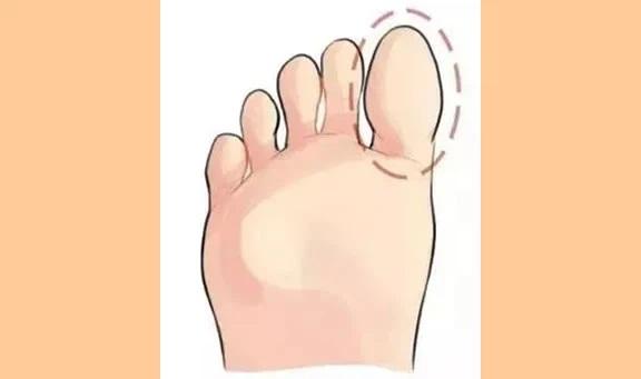 Đây là tướng bàn chân phú quý, phụ nữ nào sở hữu thì xác định đời này giàu sang-1