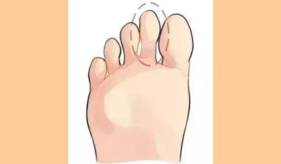 Đây là tướng bàn chân phú quý, phụ nữ nào sở hữu thì xác định đời này giàu sang-2