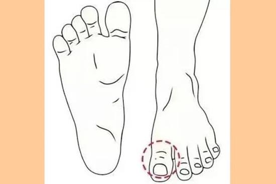 Đây là tướng bàn chân phú quý, phụ nữ nào sở hữu thì xác định đời này giàu sang
