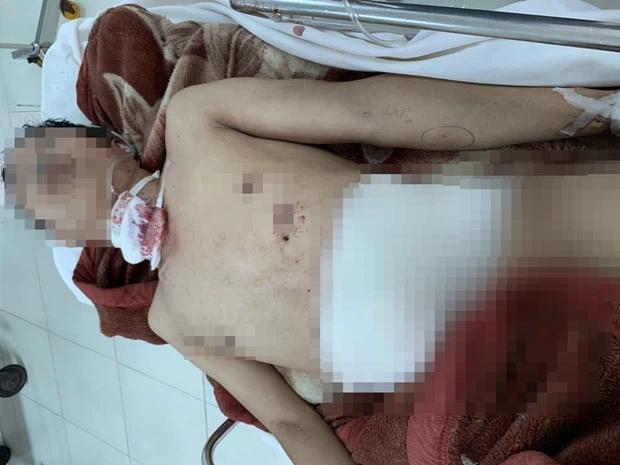 Vụ án mạng 3 người thương vong: Ghen tuông, chồng đâm chết đầu bếp, chém vợ cũ rồi tự sát-2