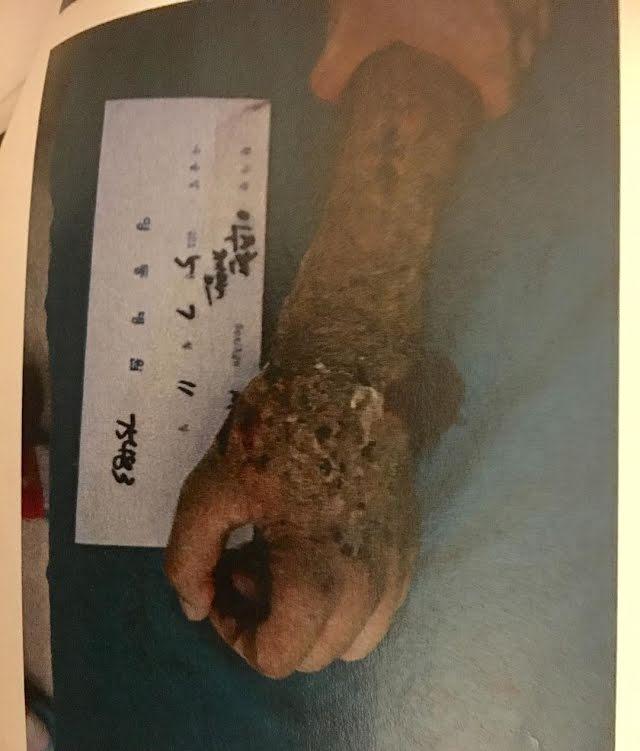 Những idol Kpop từng suýt bỏ mạng trước lưỡi hái tử thần-10