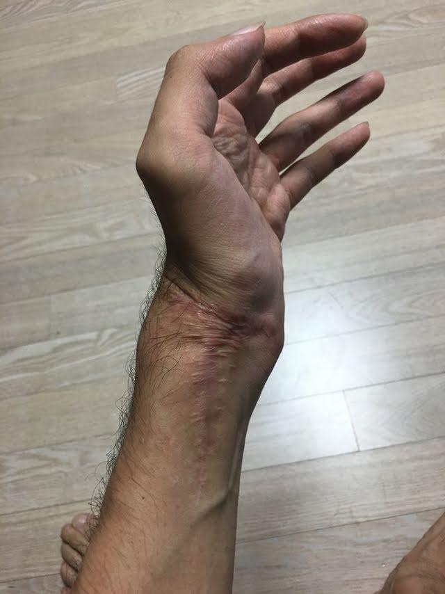 Những idol Kpop từng suýt bỏ mạng trước lưỡi hái tử thần-11