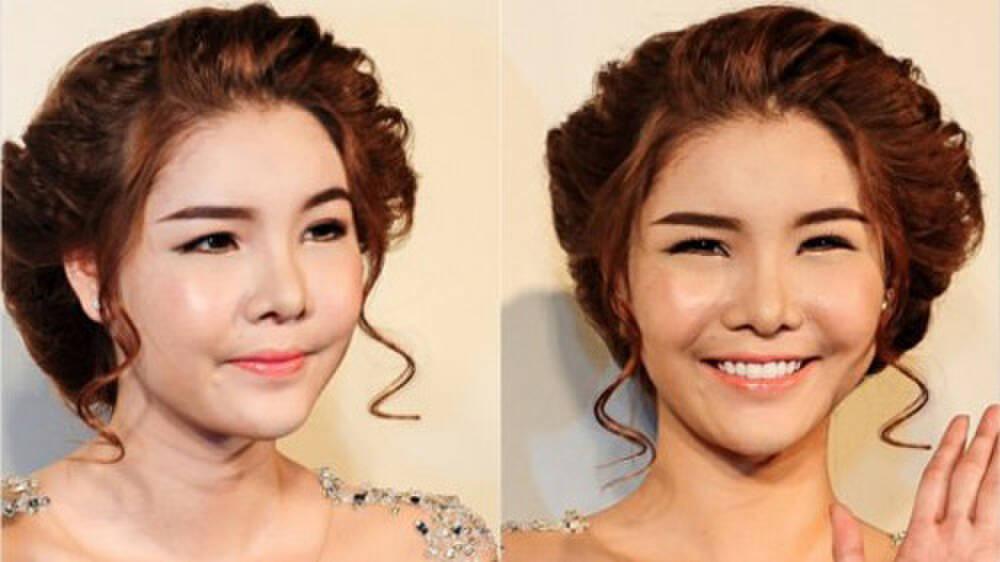 Những bộ phận bị cho biến dạng vì phẫu thuật thẩm mỹ của sao Việt-7