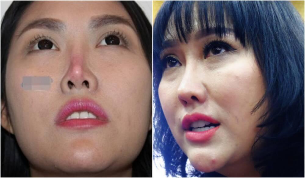 Những bộ phận bị cho biến dạng vì phẫu thuật thẩm mỹ của sao Việt-12