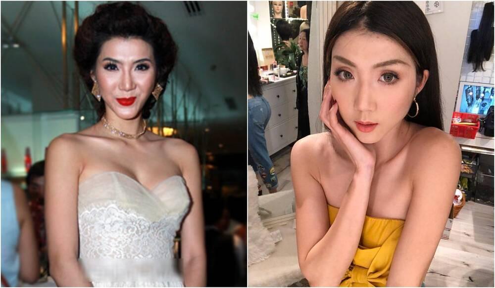 Những bộ phận bị cho biến dạng vì phẫu thuật thẩm mỹ của sao Việt-10