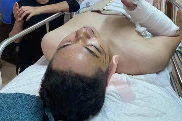 Vụ sập sàn chung cư ở Hà Nội: Nạn nhân gãy xương sống-5