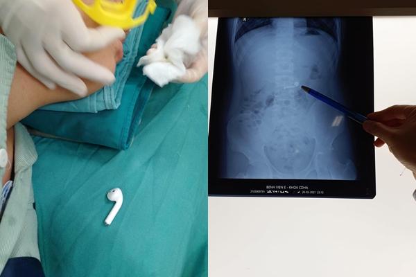 Bắt chước ảo thuật gia, bé trai 8 tuổi nuốt đồng xu rồi mắc nghẹn nguy kịch-4