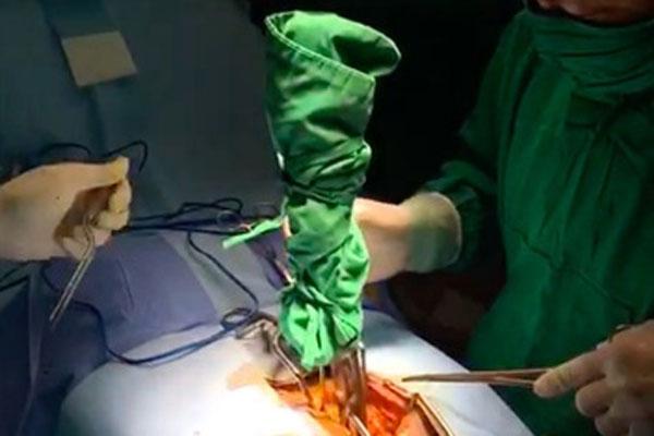 Nam thanh niên nhập viện với dao phay cắm chặt vào lưng-1