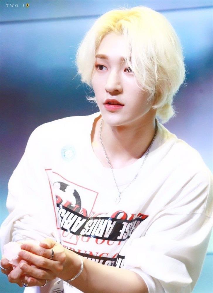 Nam Idol vì danh tiếng mà đánh đổi cả nhan sắc lẫn thị lực-8