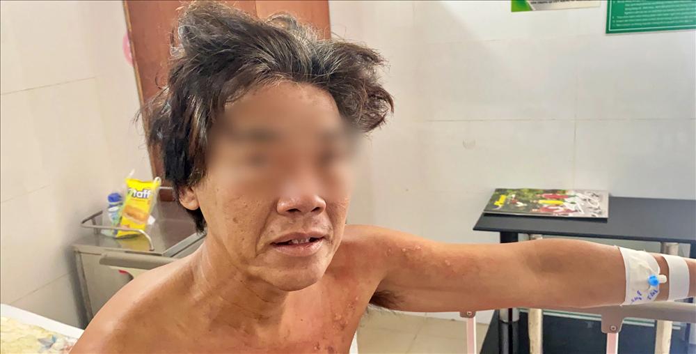 Cháy 6 người tử vong ở Thủ Đức: Người sống sót hối hận-1