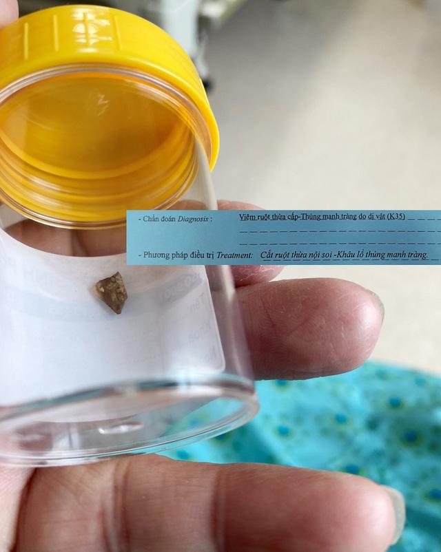 Đang khỏe mạnh bị bác sĩ yêu cầu mổ gấp, bệnh nhân tá hỏa-2