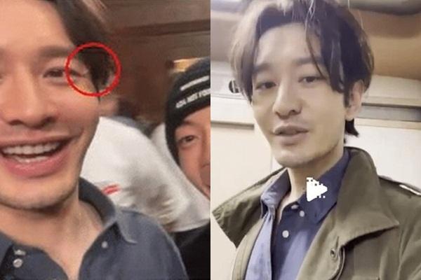 Huỳnh Hiểu Minh rối loạn nhịp tim sau khi giảm 15 kg-3