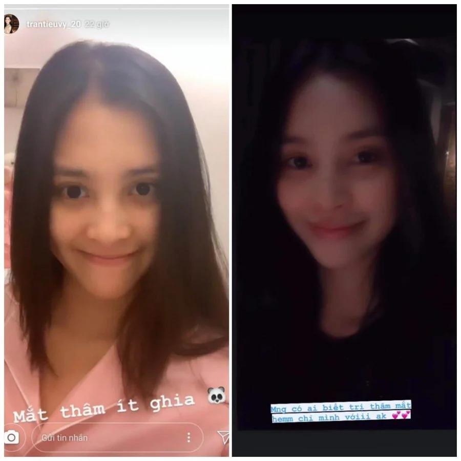 Hoa hậu Tiểu Vy khoe cận mặt mộc, khuyết điểm quầng thâm biến mất-6