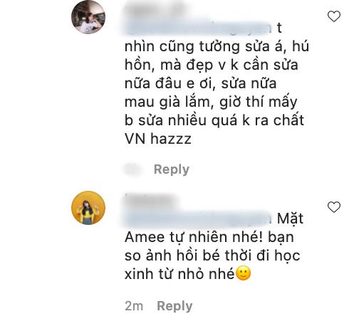 Amee đáp trả khi bị chê tuổi này sửa mặt là sai lầm-4