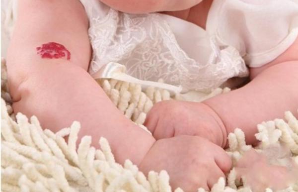 Ai sở hữu vết bớt ở 4 vị trí này thì cả đời giàu sang phú quý, vạn sự như ý-3