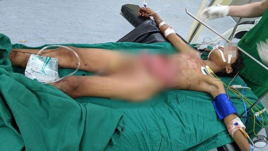 Thiếu niên bị thanh sắt rạch ngang bụng, nội tạng xổ hết ra ngoài-1