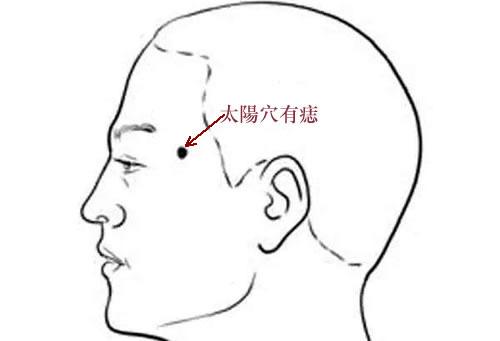 Có 1 trong 6 nốt ruồi ở vị trí này, bạn có khả năng kiếm tiền siêu phàm-1