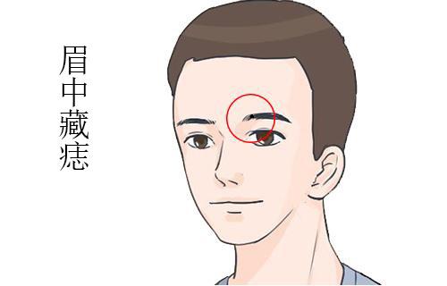 Có 1 trong 6 nốt ruồi ở vị trí này, bạn có khả năng kiếm tiền siêu phàm-4