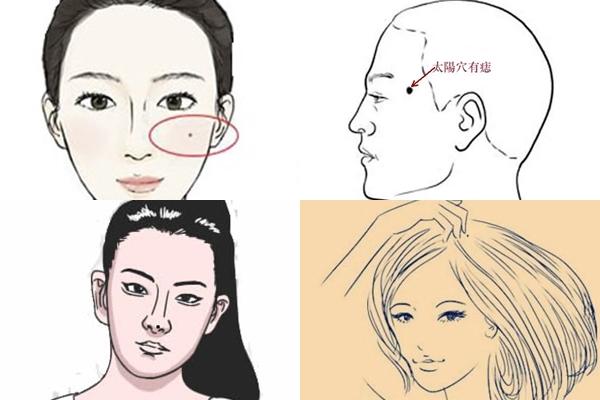 Bạn có 4 nốt ruồi phú quý nhất trên người không?-5