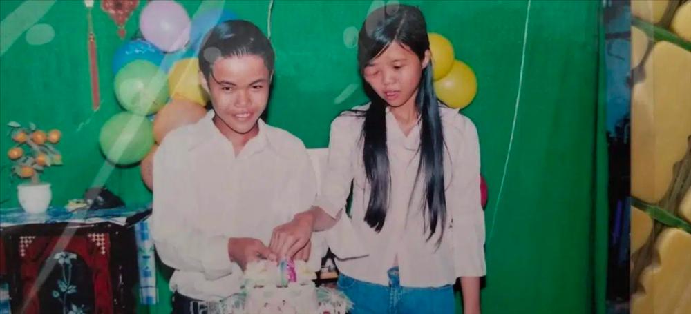 Mẹ đơn thân một mắt và 3 cuộc đại phẫu, phản ứng con gái gặp lại mẹ rớt nước mắt-2