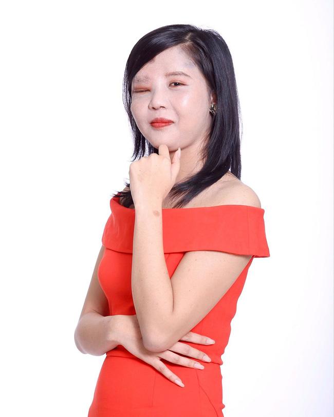 Mẹ đơn thân một mắt và 3 cuộc đại phẫu, phản ứng con gái gặp lại mẹ rớt nước mắt-7