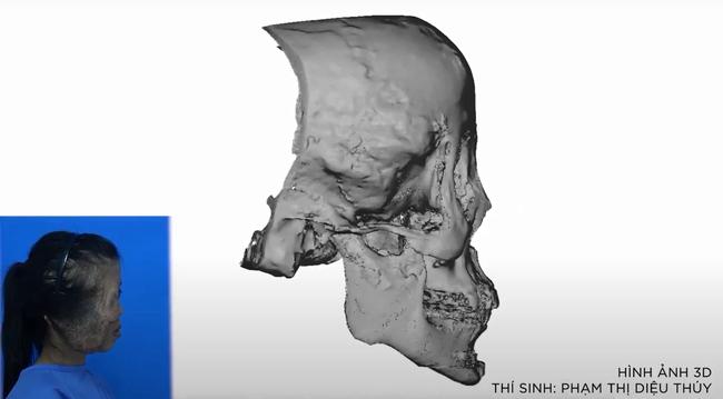Mẹ đơn thân một mắt và 3 cuộc đại phẫu, phản ứng con gái gặp lại mẹ rớt nước mắt-5