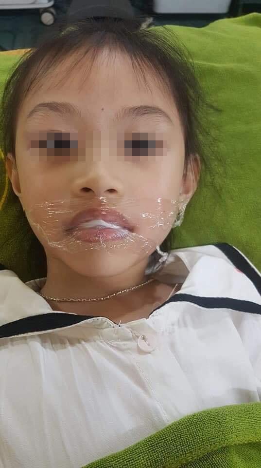 Xôn xao chuyện phụ huynh để bé gái 5 tuổi xăm môi đỏ mọng-2