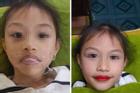 Xôn xao chuyện phụ huynh để bé gái 5 tuổi xăm môi đỏ mọng