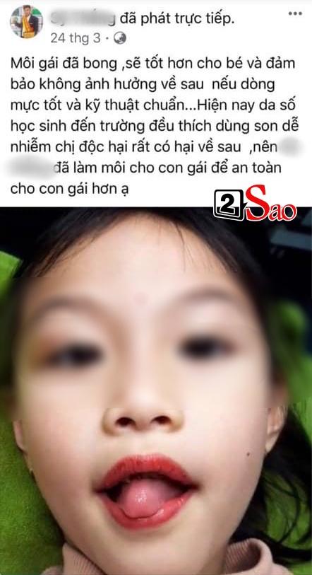 Bé 5 tuổi xăm môi: Bố mẹ bé thách thức ai chửi tự khẩu nghiệp-2