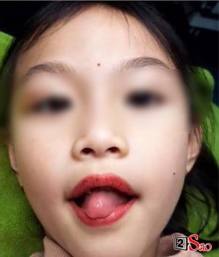 Bé 5 tuổi xăm môi: Bố mẹ bé thách thức ai chửi tự khẩu nghiệp-5