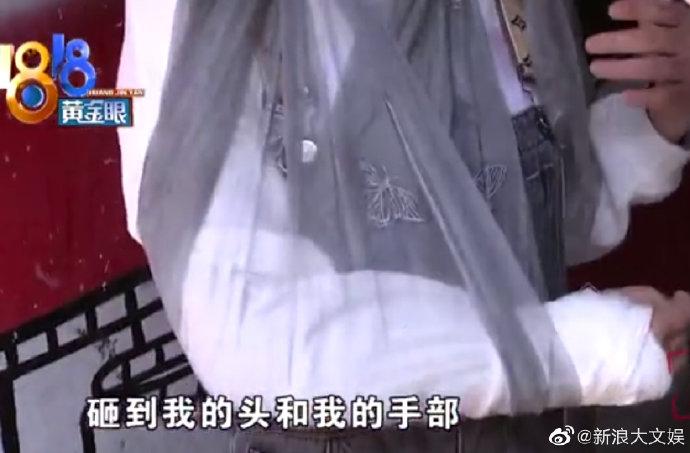 Quán lẩu mỹ nam Trần Hách sập trần, 2 người đang ăn phải cấp cứu-3