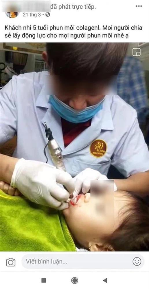 Từ chuyện bé 5 tuổi phun môi collagen: Phun xăm môi cho trẻ em dẫn đến những hệ lụy gì?-1