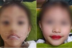 Từ chuyện bé 5 tuổi phun môi collagen: Phun xăm môi cho trẻ em dẫn đến những hệ lụy gì?