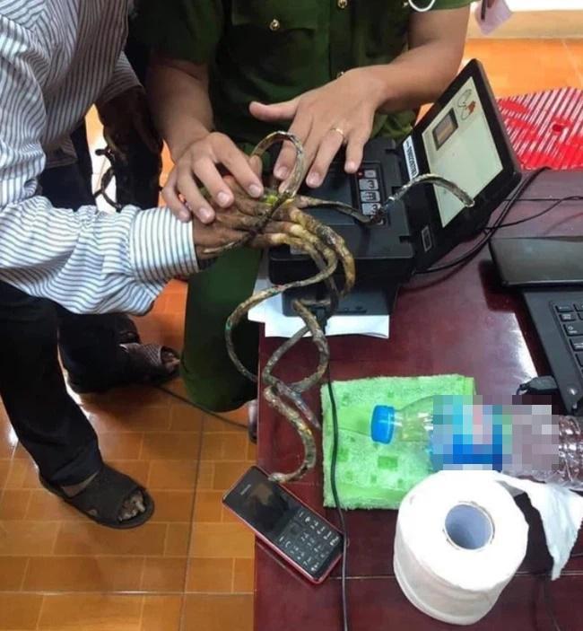 Thanh niên mắc chứng mồ hôi tay kể hành trình làm căn cước như đánh vật-1