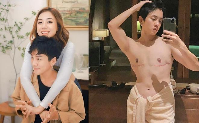 Người yêu đồng giới của Miko Lan Trinh bức xúc khi bị cười cợt cắt bỏ ngực-2