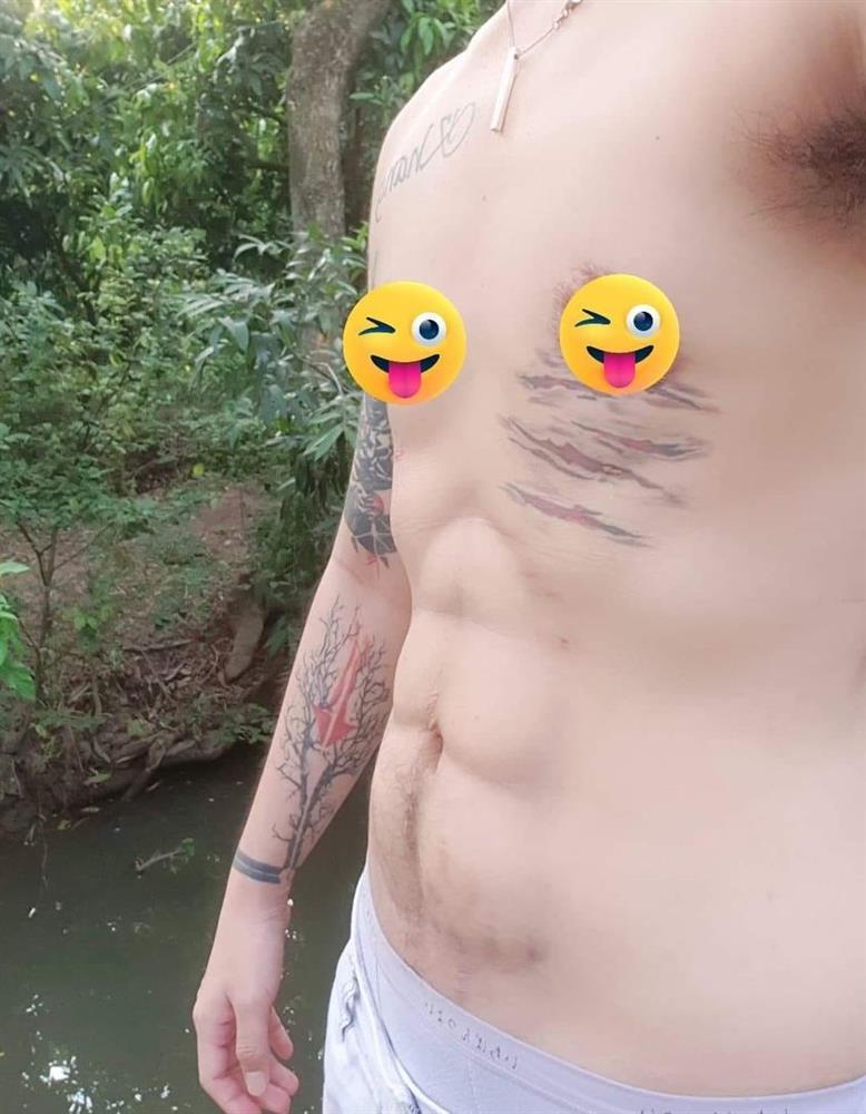 Người đàn ông Việt Nam sinh con khoe múi bụng sau khi cắt tử cung-1