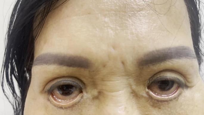 Cảnh báo tai nạn khi chỉnh trang cửa sổ tâm hồn-1