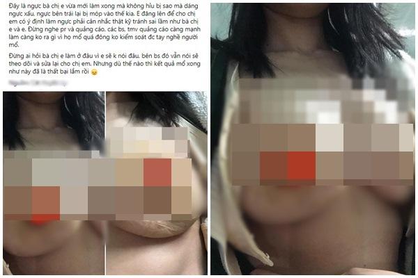 3 phương pháp trùng tu vòng 1 hot nhất hiện nay và những lưu ý quan trọng-7