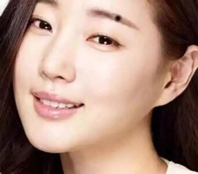 Bạn có 4 nốt ruồi phú quý nhất trên người không?-4