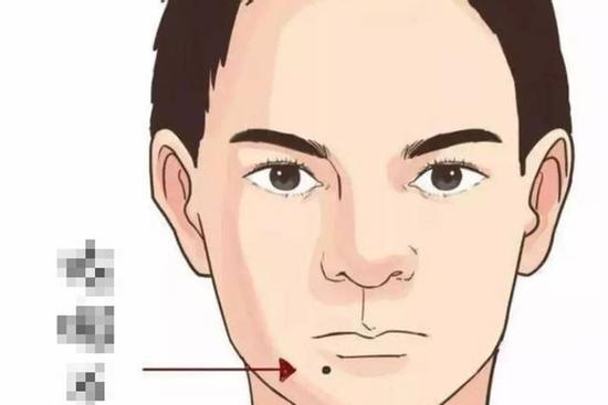 Bạn có 4 nốt ruồi phú quý nhất trên người không?