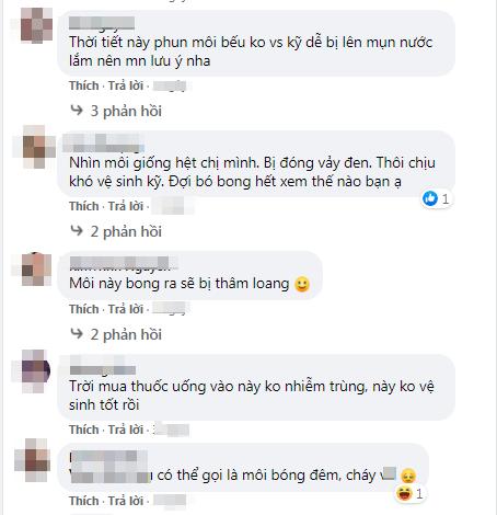 Phun môi collagen siêu hot, cô gái khóc ngất vì đôi môi khác gì bánh mì cháy-2