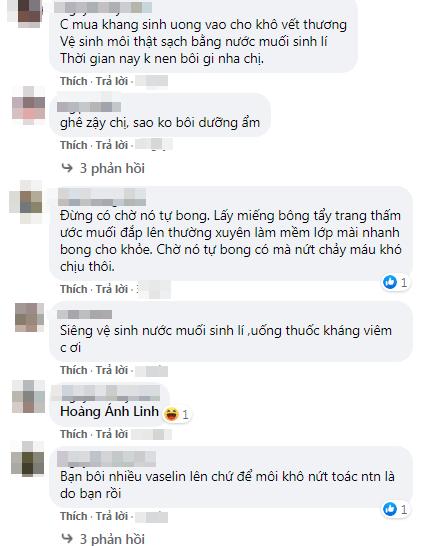 Phun môi collagen siêu hot, cô gái khóc ngất vì đôi môi khác gì bánh mì cháy-3