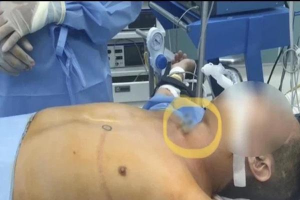 Cán bộ xã tự tử trong khu cách ly phòng dịch COVID-19-1