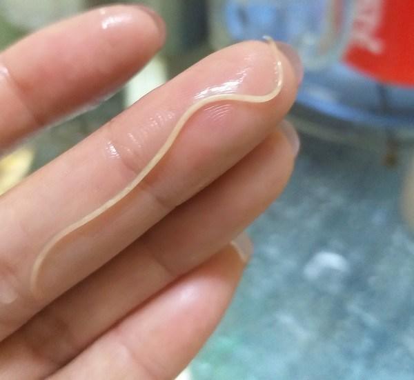 Xuất hiện clip lòng trắng trứng gà nghi nhiễm giun sán, chuyên gia nói gì?-2