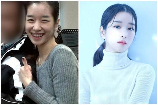 'Điên nữ' Seo Ye Ji lộ khuyết điểm cười hở lợi, ảnh quá khứ khác xa hiện tại